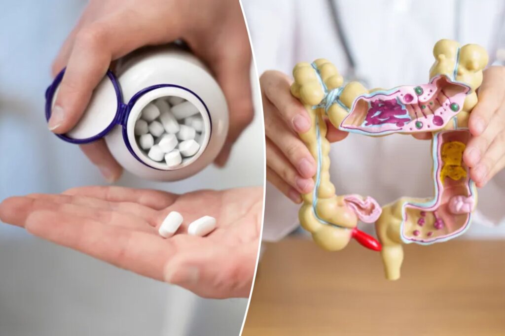 Daily dose of baby aspirin can halve the possibilities of obtaining colorectal cancer if you have this condition